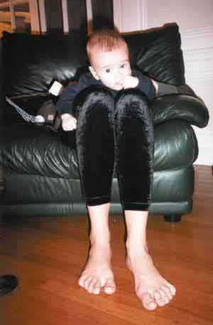Niño con piernas largas